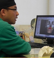 正顎顱顏整形大躍進　3D列印顛覆傳統術式